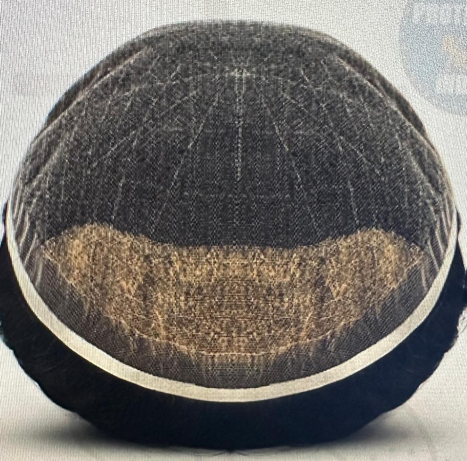protez sac Falugnaft modeli