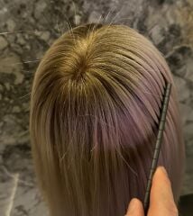 medıcal komple protez saclar